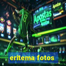 eritema fotos