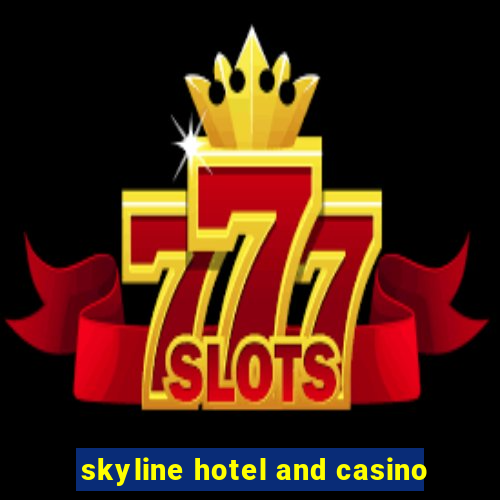 skyline hotel and casino