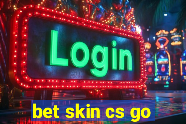 bet skin cs go