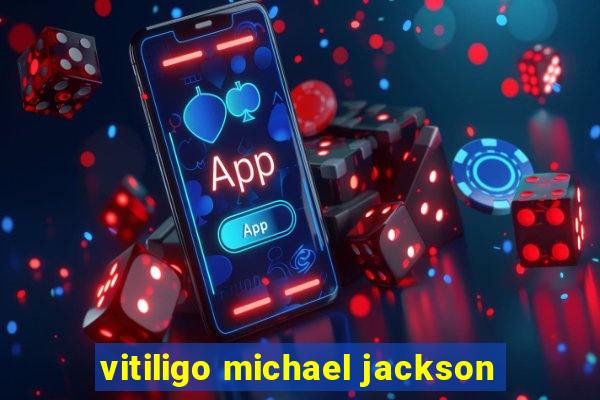 vitiligo michael jackson